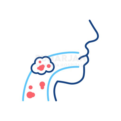 Oral CAncer Treatment Hospitals