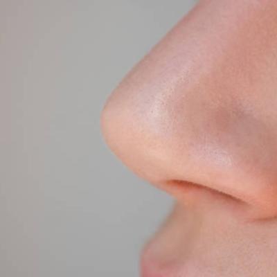 Rhinoplasty in Riyadh